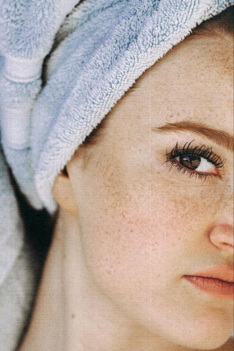 A woman with a towel on her hair with glowing skin and freckles.