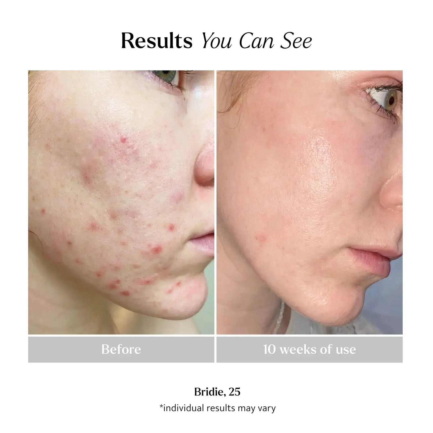 Foaming Deep Cleanser Lemon &amp; Beaker